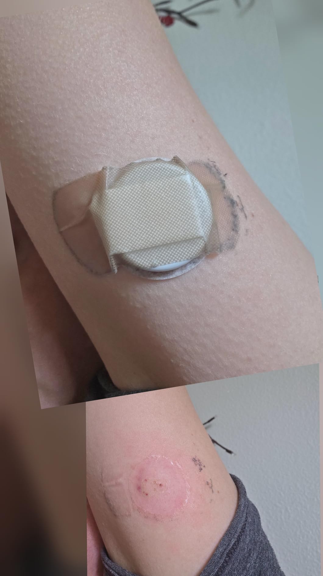 Lingo Continuous Glucose Monitor (CGM) by Abbott - 1 Biosensor, Up to 14 Days, iOS & Android customer photo 2
