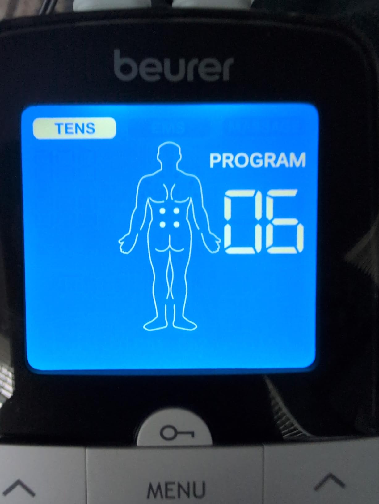 Beurer EM59 Digital 3-in-1 TENS Unit, EMS & Heat Therapy for Pain Relief & Relaxation, Muscle Stimulator with 2 Adjustable Channels, 64 Applications, Timer Function customer photo 1