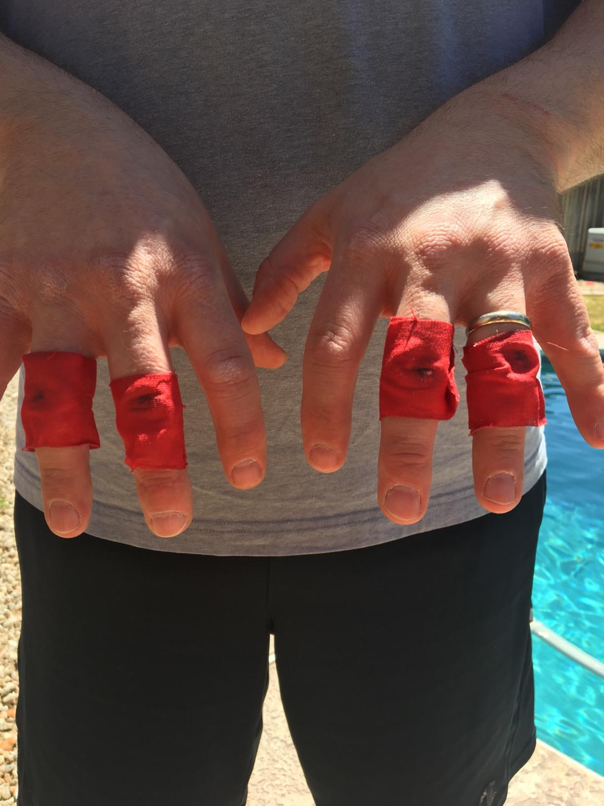 Eucatape Eucalyptus Infused Rowing Tape for Men & Women - Heals and Protects Hands from Blisters Cuts Dry Skin, for Strength & Grip Indoor Machine or Outdoor Sculling Crew customer photo 1