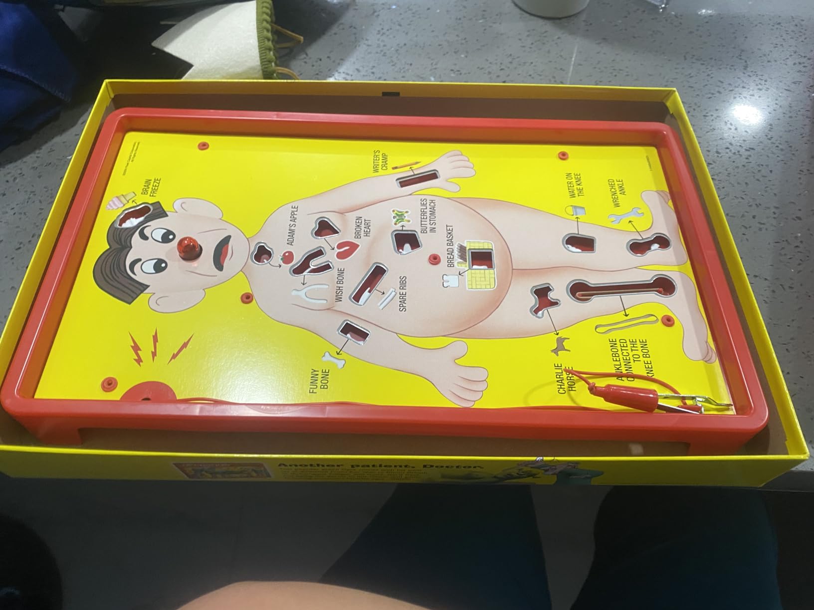 Hasbro Gaming Operation Electronic Board Game, Family Games for Kids Ages 6+, Kids Board Games for 1+ Players, Funny Games for Kids, Easter Gifts for Boys and Girls (Amazon Exclusive) customer photo 2