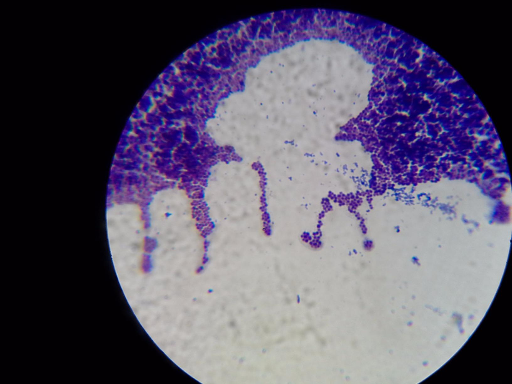 OMAX M82ES-SC100-LP100-OM 2000X LED Binocular Compound Lab Microscope customer photo 2