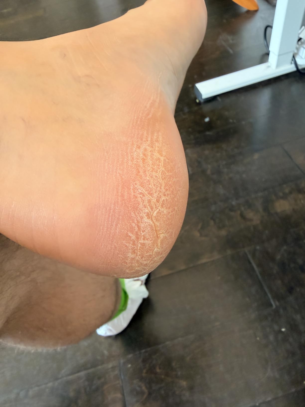 Colossal Foot rasp Foot File and Callus Remover. Best Foot Care Pedicure Metal Surface Tool to Remove Hard Skin. Can be Used on Both Wet and Dry feet, High Grade Stainless Steel File customer photo 2