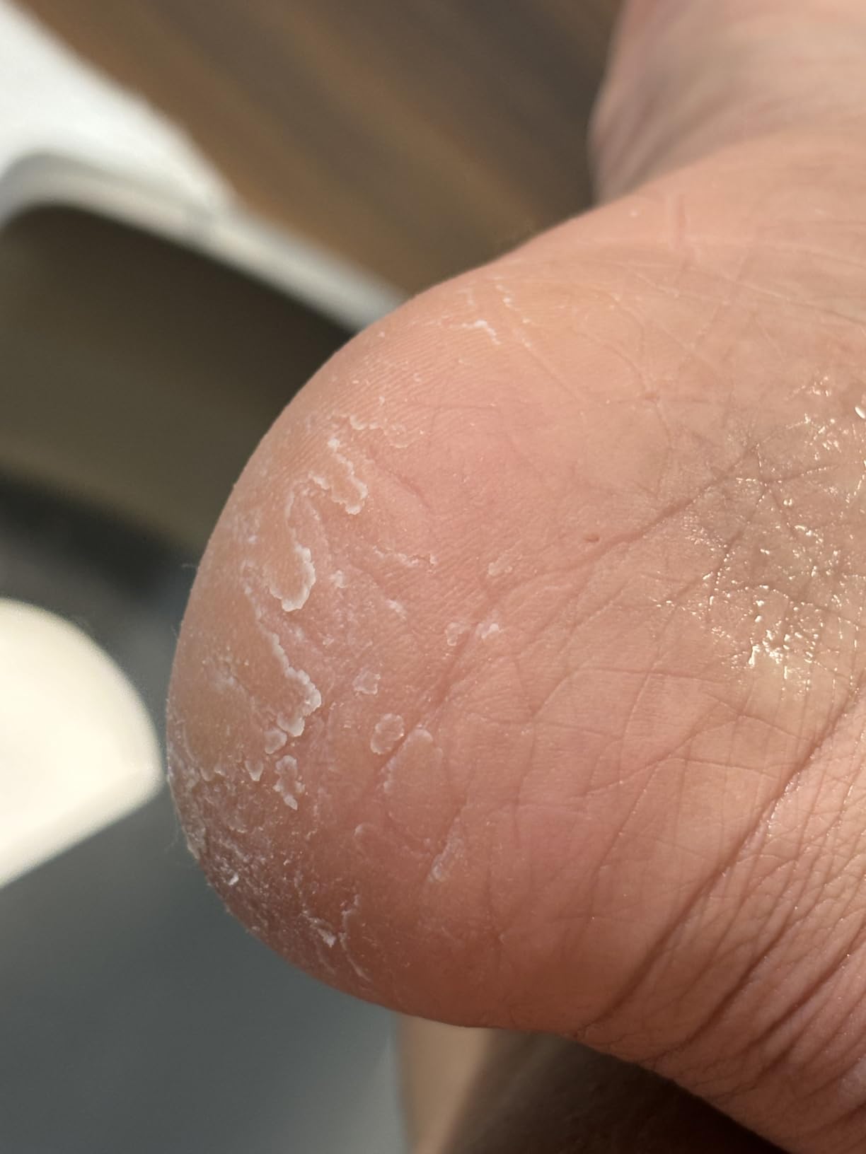 Lee Beauty 8oz Professional Gel Callus Remover for Feet - Original Fast-Acting Formula, Extra Strength for Cracked Heels & Dead Skin (Pack of 1) customer photo 1