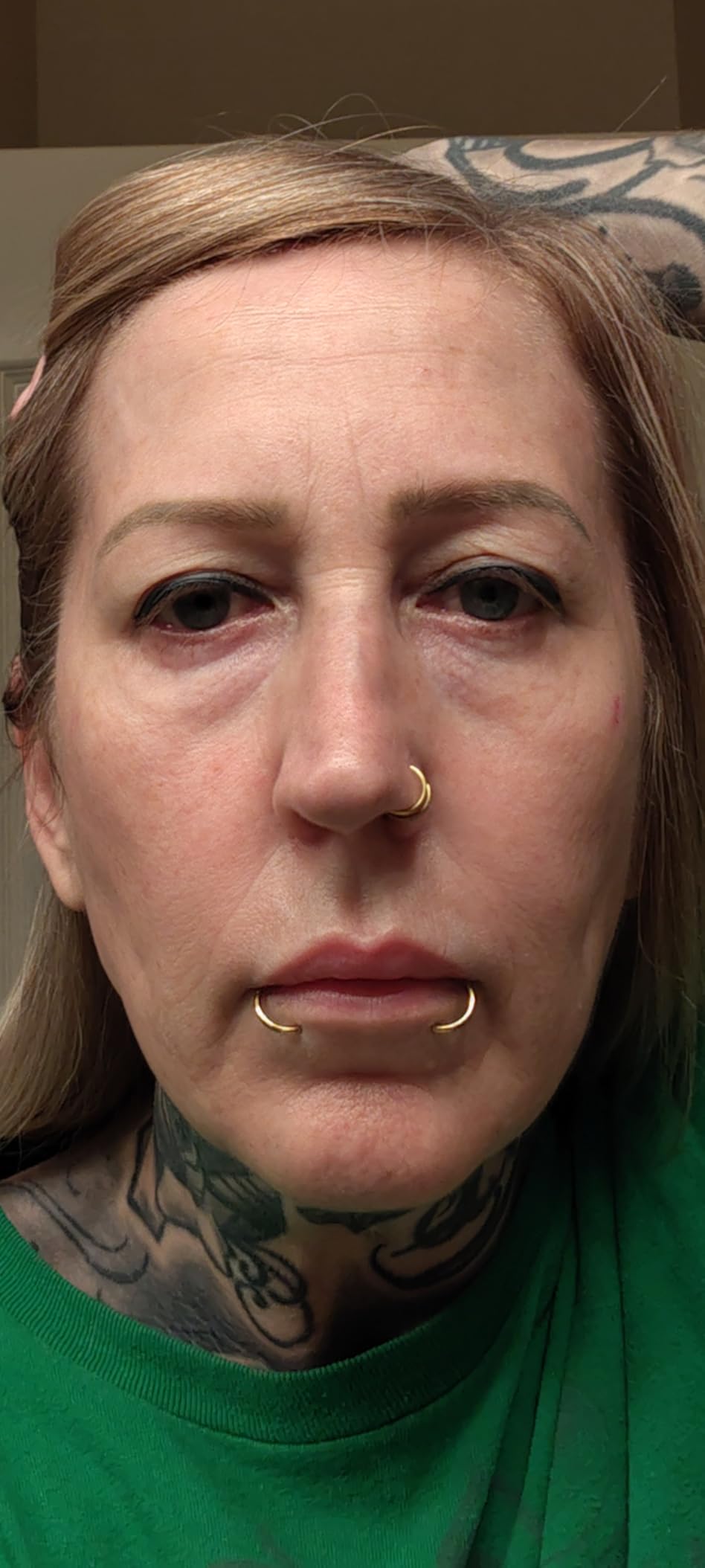 SPA SCIENCES - SIMA Patented Dermaplane Razor for Women Face customer photo 2