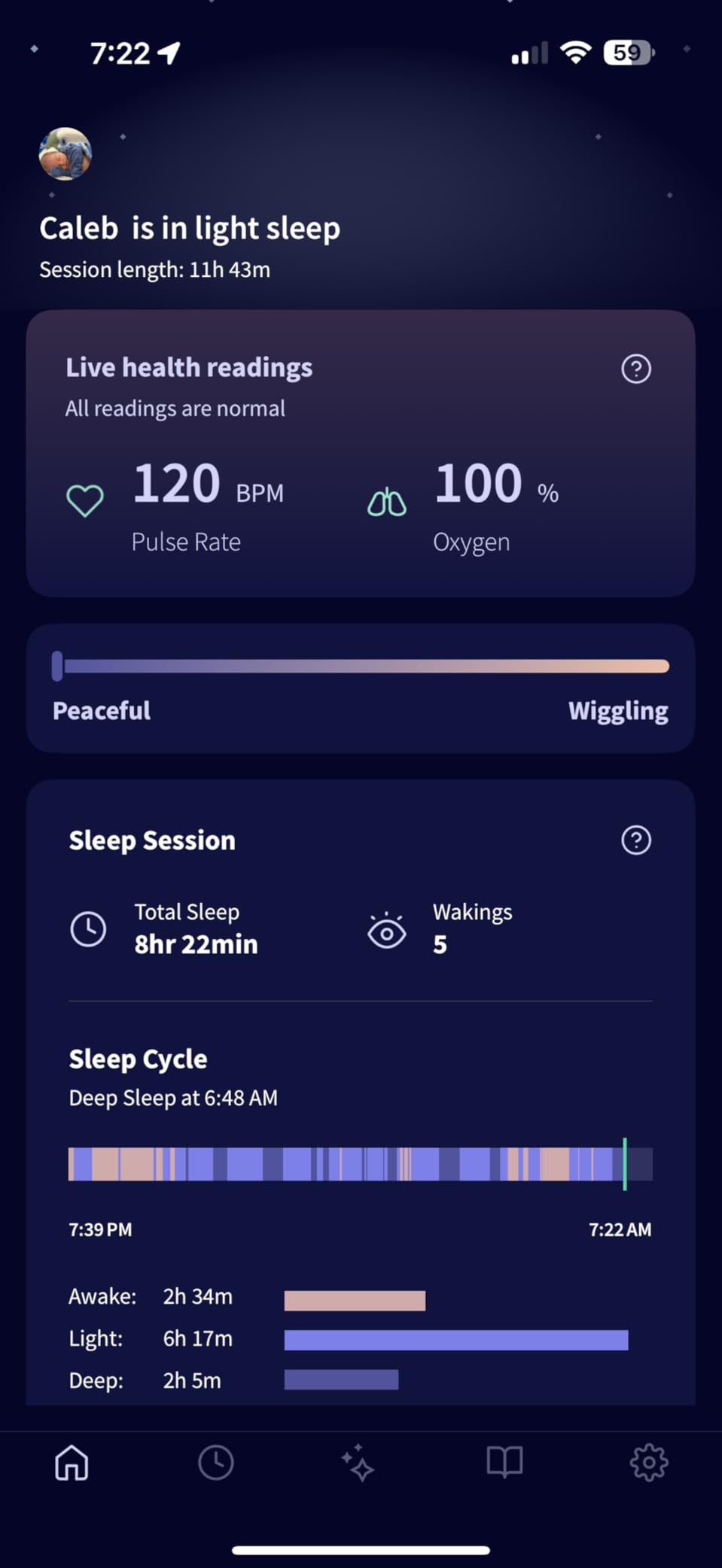 Owlet Dream Sock Smart Baby Monitor, Better Sleep for Baby & You customer photo 2