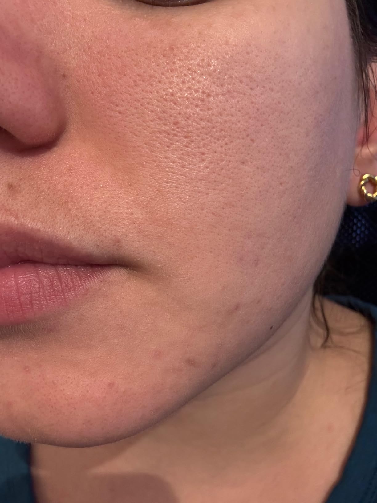La Roche-Posay Effaclar Mat Oil Free Face Moisturizer for Oily Skin customer photo 2