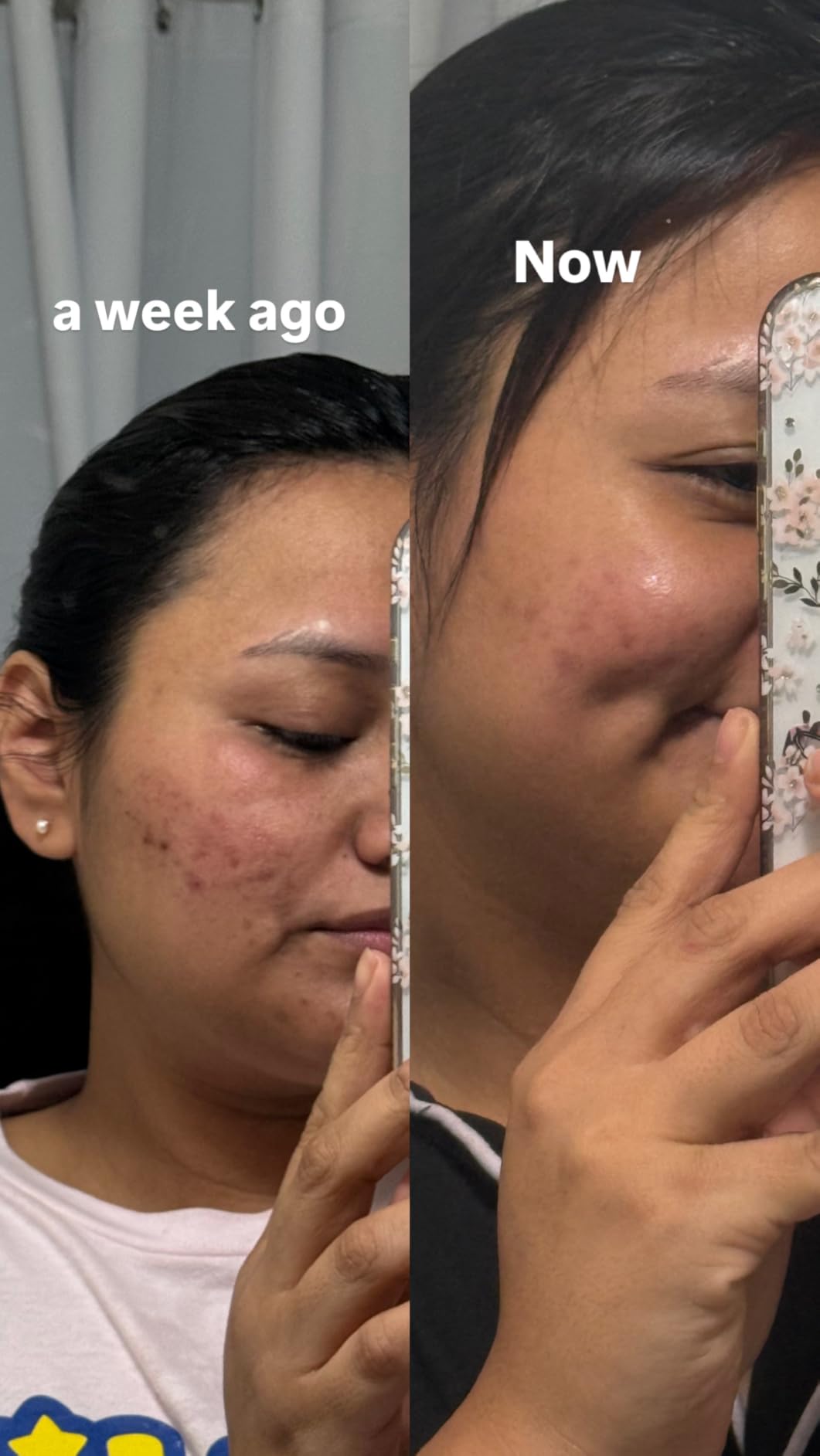 La Roche-Posay Effaclar Clarifying Solution Salicylic Acid Toner, 6.7oz customer photo 1