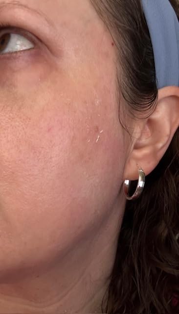 La Roche-Posay Anthelios Clear Skin Dry Touch Sunscreen for Face, SPF 60 customer photo 1